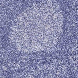 RCAN1 Rabbit anti-Human, Polyclonal, Novus Biologicals 100 &mu;g; Unconjugated:Antibodies,
