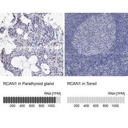 RCAN1 Rabbit anti-Human, Polyclonal, Novus Biologicals 100 &mu;g; Unconjugated:Antibodies,