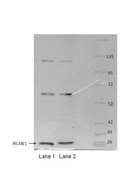 RCAN1 Antibody, Novus Biologicals 100 &mu;L | Buy Online | Novus Biologicals | Fisher Scientific
