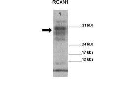 RCAN1 Antibody, Novus Biologicals 100 &mu;L | Buy Online | Novus Biologicals | Fisher Scientific