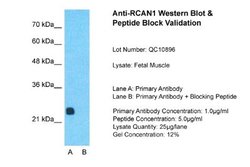 RCAN1 Antibody, Novus Biologicals 100 &mu;L | Buy Online | Novus Biologicals | Fisher Scientific