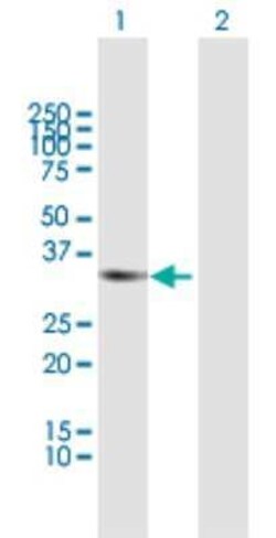 RCBTB1 Antibody, Novus Biologicals 0.05 mg | Buy Online | Novus Biologicals | Fisher Scientific