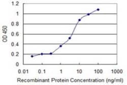 Novus Biologicals RCBTB2 Antibody (2G4), Novus Biologicals 0.1 mg | Buy Online | Novus Biologicals&trade; | Fisher Scientific