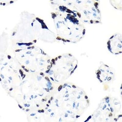 RCC1 Rabbit anti-Human, Mouse, Rat, Clone: 1F0C5, Novus Biologicals 100