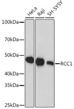 RCC1 Rabbit anti-Human, Mouse, Rat, Clone: 1F0C5, Novus Biologicals 100