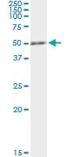 RCC1 Antibody (1C1), Novus Biologicals 0.1 mg; Unconjugated:Antibodies,