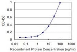 RCC1 Antibody (1C1), Novus Biologicals 0.1 mg; Unconjugated:Antibodies,