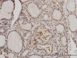 RCC1 Antibody (2F1), Novus Biologicals 0.1 mg | Buy Online | Novus Biologicals | Fisher Scientific