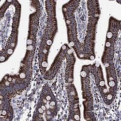RCE1 Rabbit anti-Human, Polyclonal, Novus Biologicals 100 &mu;g; Unconjugated:Antibodies,
