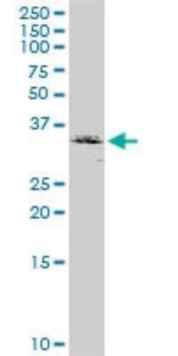 RCN2 Antibody, Novus Biologicals 0.1 mg, Unconjugated:Antibodies, Polyclonal