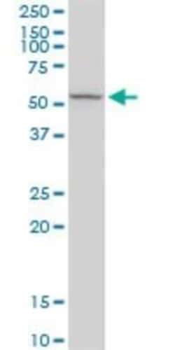 RCN2 Antibody, Novus Biologicals 0.1 mg, Unconjugated:Antibodies, Polyclonal