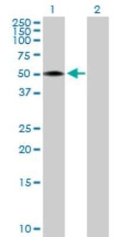 RCN2 Antibody, Novus Biologicals 0.1 mg, Unconjugated:Antibodies, Polyclonal