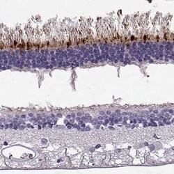 RD3 Antibody, Novus Biologicals:Antibodies:Primary Antibodies