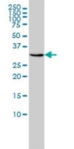 RDH11 Antibody (1H6), Novus Biologicals 0.1 mg | Buy Online | Novus Biologicals | Fisher Scientific