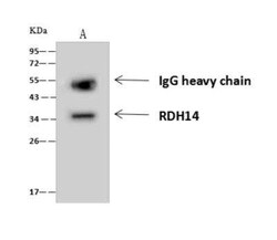 RDH14 Antibody, Novus Biologicals 50 &mu;g; Unconjugated:Antibodies, Polyclonal