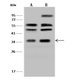 RDH14 Antibody, Novus Biologicals 50 &mu;g; Unconjugated:Antibodies, Polyclonal