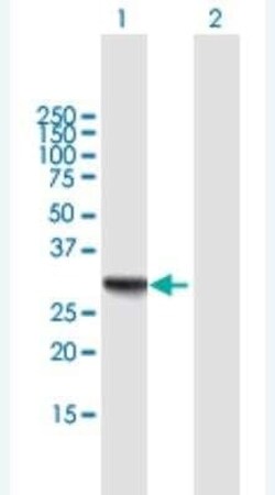 RDH16 Antibody, Novus Biologicals 50 &mu;g | Buy Online | Novus Biologicals | Fisher Scientific