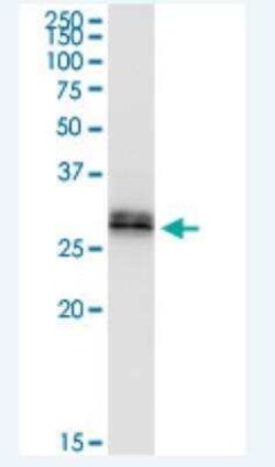 RDH16 Antibody, Novus Biologicals 50 &mu;g | Buy Online | Novus Biologicals | Fisher Scientific
