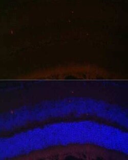 RDH5 Antibody - BSA Free, Novus Biologicals 0.1 mL; Unconjugated:Antibodies,