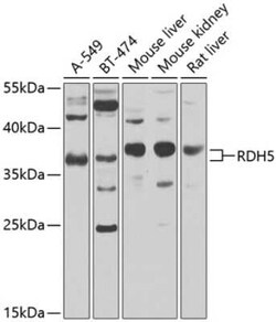 RDH5 Antibody - BSA Free, Novus Biologicals 0.1 mL; Unconjugated:Antibodies,