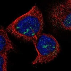 RDM1 Antibody, Novus Biologicals:Antibodies:Primary Antibodies