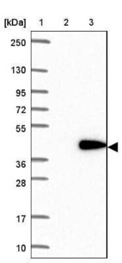 RDM1 Antibody, Novus Biologicals:Antibodies:Primary Antibodies