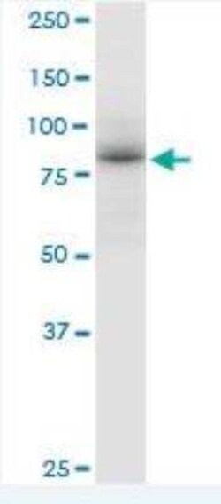 RED1 Antibody, Novus Biologicals 0.05 mg | Buy Online | Novus Biologicals | Fisher Scientific