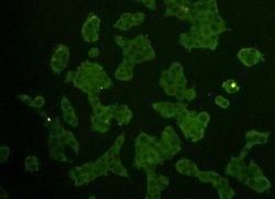 REM2 Mouse anti-Human, Clone: B4-D6, Novus Biologicals 100&mu;L:Antibodies,