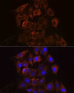 RENT1/UPF1/hUPF1 Rabbit anti-Human, Mouse, Rat, Clone: 5D5C4, Novus Biologicals 20 &mu;g | Buy Online | Novus Biologicals | Fisher Scientific