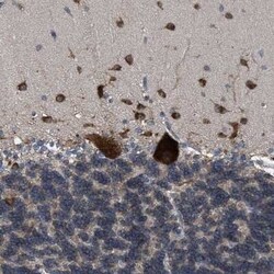 RENT1/UPF1/hUPF1 Antibody, Novus Biologicals:Antibodies:Primary Antibodies