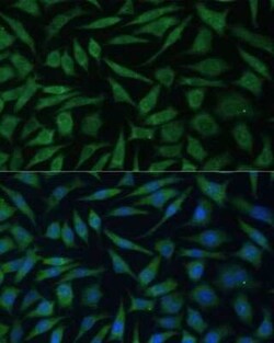 REXO2 Antibody - Azide and BSA Free, Novus Biologicals 0.1 mL; Unconjugated:Antibodies,