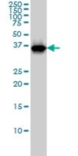 RFC4 Antibody (1C12), Novus Biologicals 0.1 mg | Buy Online | Novus Biologicals | Fisher Scientific