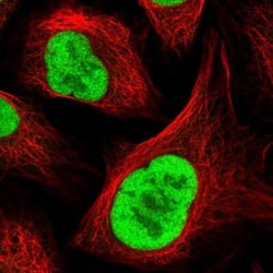 RFC4 Antibody, Novus Biologicals 25 &mu;L, Unconjugated:Antibodies, Polyclonal