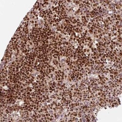 RFC4 Antibody, Novus Biologicals 25 &mu;L, Unconjugated:Antibodies, Polyclonal