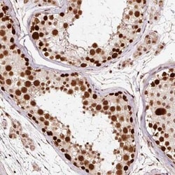 RFC4 Antibody, Novus Biologicals 25 &mu;L, Unconjugated:Antibodies, Polyclonal