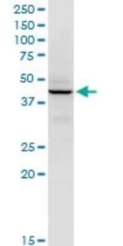 RFC5 Antibody (1B1), Novus Biologicals 0.1 mg, Unconjugated:Anticuerpos