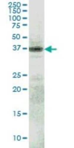 RFNG Antibody (6C7), Novus Biologicals 0.1 mg | Buy Online | Novus Biologicals | Fisher Scientific