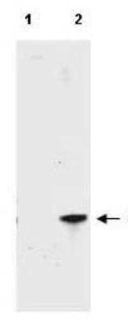 RFP Antibody, Novus Biologicals 100 &mu;g; Unconjugated:Antibodies, Polyclonal