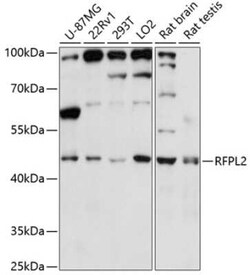 RFPL2 Antibody - Azide and BSA Free, Novus Biologicals:Antibodies:Primary
