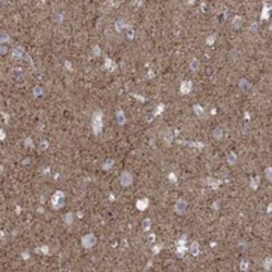 RFTN2 Rabbit anti-Human, Polyclonal, Novus Biologicals 100 &mu;g; Unconjugated:Antibodies,