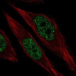 RFX1 Rabbit anti-Human, Polyclonal, Novus Biologicals 100 &mu;g; Unconjugated:Antibodies,