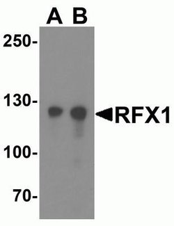 RFX1 Antibody - BSA Free, Novus Biologicals 0.1 mg; Unconjugated:Antibodies,