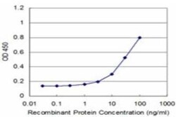 RFXANK Antibody (4G10), Novus Biologicals 0.1 mg | Buy Online | Novus Biologicals | Fisher Scientific