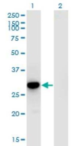 RFXANK Antibody (4G10), Novus Biologicals 0.1 mg | Buy Online | Novus Biologicals | Fisher Scientific