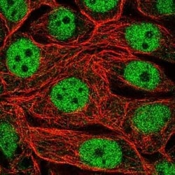 RFXANK Antibody, Novus Biologicals 0.1 mL | Buy Online | Novus Biologicals | Fisher Scientific