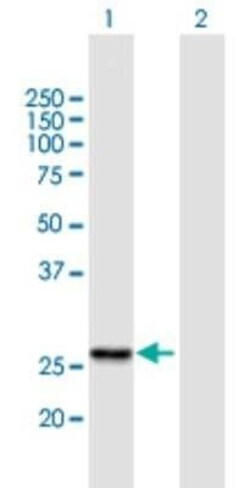 RG9MTD1 Antibody, Novus Biologicals 0.05 mg | Buy Online | Novus Biologicals | Fisher Scientific