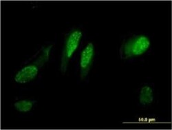 RGC32 Antibody (3B9), Novus Biologicals 0.1 mg | Buy Online | Novus Biologicals | Fisher Scientific