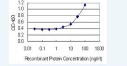 RGM-A Antibody (6D7), Novus Biologicals 100 &mu;g | Buy Online | Novus Biologicals | Fisher Scientific
