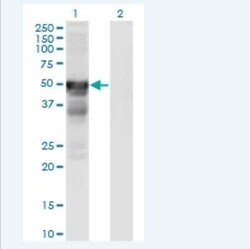 RGM-A Antibody (6D7), Novus Biologicals 100 &mu;g | Buy Online | Novus Biologicals | Fisher Scientific