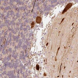RGPD5 Antibody, Novus Biologicals 25 &mu;L, Unconjugated:Antibodies, Polyclonal